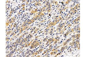 anti-MRS2 Magnesium Homeostasis Factor Homolog (MRS2) antibody