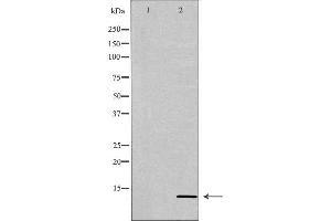 Western blot analysis of extracts of HeLa, using PATE3 antibody. (PATE3 Antikörper  (Internal Region))