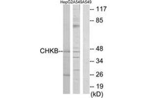 Western blot analysis of extracts from HepG2/A549 cells, using CHKB Antibody. (CHKB Antikörper  (AA 301-350))