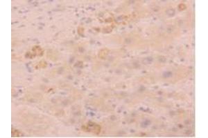 IHC-P analysis of Human Liver Tissue, with DAB staining. (FGL1 Antikörper  (AA 23-312))