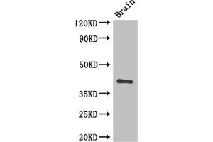 Western Blot Positive WB detected in: Mouse brain tissue All lanes: CD34 antibody at 3 μg/mL Secondary Goat polyclonal to rabbit IgG at 1/50000 dilution Predicted band size: 41, 36 kDa Observed band size: 41 kDa (CD34 Antikörper  (AA 124-375))