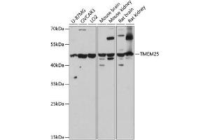 Western blot analysis of extracts of various cell lines, using TMEM25 antibody (ABIN7270963) at 1:3000 dilution. (TMEM25 Antikörper  (AA 223-322))