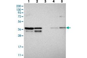 Western blot analysis of Lane 1: RT-4, Lane 2: U-251 MG, Lane 3: Human Plasma, Lane 4: Liver, Lane 5: Tonsil with SNRNP40 polyclonal antibody  at 1:250-1:500 dilution. (SNRNP40 Antikörper)