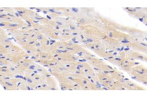 Detection of IkBb in Mouse Cardiac Muscle Tissue using Polyclonal Antibody to Inhibitory Subunit Of NF Kappa B Beta (IkBb) (Inhibitory Subunit of NF kappa B beta (AA 117-345) Antikörper)