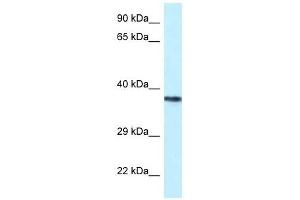 Western Blot showing PSTPIP2 antibody used at a concentration of 1 ug/ml against Jurkat Cell Lysate