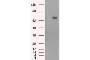 HEK293T cells were transfected with the pCMV6-ENTRY control (Left lane) or pCMV6-ENTRY BTK (Right lane) cDNA for 48 hrs and lysed. (BTK Antikörper)