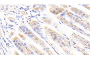 Detection of BFP in Mouse Stomach Tissue using Polyclonal Antibody to Brain Finger Protein (BFP) (RNF112 Antikörper  (AA 403-647))