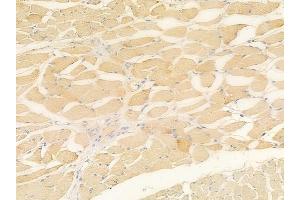 anti-Deleted in Lung and Esophageal Cancer 1 (DLEC1) (N-Term) antibody