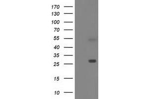 Western Blotting (WB) image for anti-Sepiapterin Reductase (SPR) antibody (ABIN1501112) (SPR Antikörper)