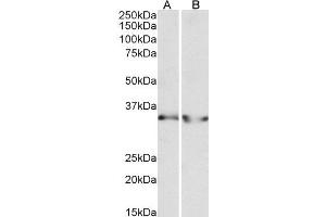 ABIN4902694 (0. (LDHB Antikörper)