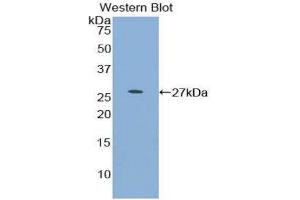 Western Blotting (WB) image for anti-Myocilin (MYOC) (AA 224-471) antibody (ABIN1859952)