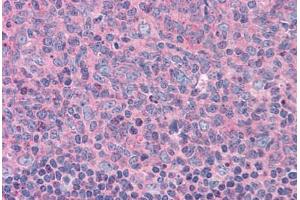 Human Tonsil: Formalin-Fixed, Paraffin-Embedded (FFPE) (ELP3/KAT9 Antikörper  (AA 240-445))