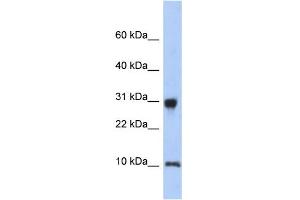 WB Suggested Anti-RPS21 Antibody Titration: 0. (RPS21 Antikörper  (N-Term))