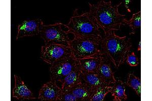 Immunofluorescence (IF) image for anti-CD63 (CD63) antibody (APC) (ABIN192268)