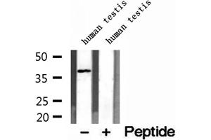 DNAJB14 Antikörper  (C-Term)