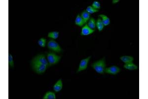 Immunofluorescence staining of Hela cells with ABIN7159221 at 1:133, counter-stained with DAPI. (MRAP Antikörper  (AA 59-172))