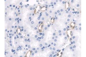 DAB staining on IHC-P; Samples: Rat Kidney Tissue (PTH2R Antikörper  (AA 27-143))