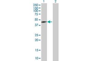 Western Blot analysis of CYP26A1 expression in transfected 293T cell line by CYP26A1 MaxPab polyclonal antibody. (CYP26A1 Antikörper  (AA 1-428))