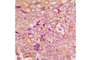 Immunohistochemistry (IHC) image for anti-PDZ and LIM Domain 5 (PDLIM5) antibody (ABIN7308152) (PDLIM5 Antikörper)