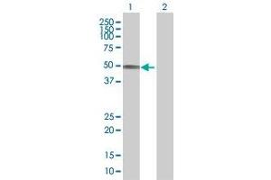 Western Blotting (WB) image for SLC16A1 293T Cell Transient Overexpression Lysate(Denatured) (ABIN1333505)