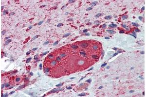 Human Small Intestine, Myenteric Plexus: Formalin-Fixed, Paraffin-Embedded (FFPE) (TUBB2A Antikörper  (AA 1-446))
