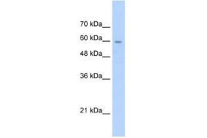 SLC22A1 antibody used at 2. (SLC22A1 Antikörper)