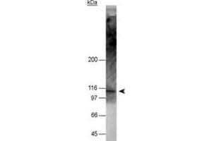 Western blot analysis of NOD2 in 50 ug of HT-29 cell lysate with NOD2 monoclonal antibody, clone 2D9 .