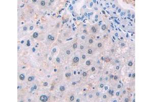 Used in DAB staining on fromalin fixed paraffin- embedded Kidney tissue (NSMAF Antikörper  (AA 176-575))