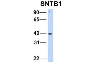 Host:  Rabbit  Target Name:  SNTB1  Sample Type:  Human HepG2  Antibody Dilution:  1.