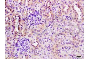 Formalin-fixed and paraffin embedded mouse kidney tissue labeled with Anti-CYP3A4 Polyclonal Antibody, Unconjugated (ABIN733793) at 1:200 followed by conjugation to the secondary antibody and DAB staining (CYP3A4 Antikörper  (AA 18-120))