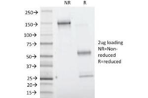 SDS-PAGE (SDS) image for anti-Villin 1 (VIL1) (AA 179-311) antibody (ABIN6940871)
