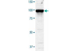 Western blot analysis of COS-1 cells transfected withPDE5A by using PDE5A polyclonal antibody  at 1:2000 dilution. (PDE5A Antikörper)