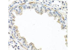 Immunohistochemistry of paraffin-embedded Mouse lung using IL22 Polyclonal Antibody at dilution of 1:100 (40x lens). (IL-22 Antikörper)