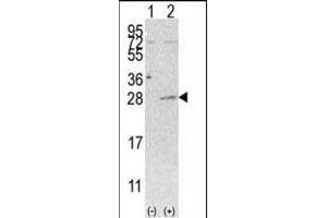 Western blot analysis of AK3 (arrow) using rabbit polyclonal AK3 Antibody (C-term H38) (ABIN392736 and ABIN2842196). (Adenylate Kinase 3 Antikörper  (C-Term))