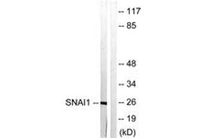 Western blot analysis of extracts from HT29 cells, using SNAI1 (Ab-246) Antibody. (SNAIL Antikörper  (AA 215-264))