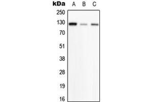 Western blot analysis of PHKB expression in HeLa (A), SP2/0 (B), H9C2 (C) whole cell lysates.
