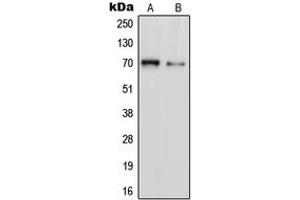 Western blot analysis of PAOX expression in Jurkat (A), HT1080 (B) whole cell lysates. (PAOX Antikörper  (Center))