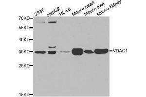 Western blot analysis of extracts of various cell lines, using VDAC1 antibody. (VDAC1 Antikörper  (AA 1-283))