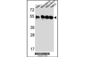 Western blot analysis of TUBB2C Antibody in Hela,MDA-MB435,MDA-MB231,HepG2 cell line lysates (35ug/lane) (TUBB2C Antikörper  (AA 99-125))