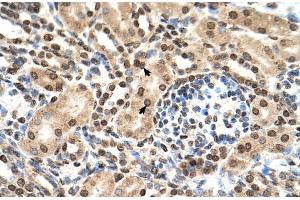 Human kidney (IFIT3 Antikörper  (N-Term))