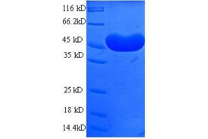 SDS-PAGE (SDS) image for Alcohol Dehydrogenase 7 (Class IV), mu Or sigma Polypeptide (ADH7) (AA 1-386), (full length) protein (His tag) (ABIN5709003)