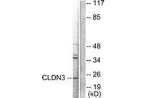 Western blot analysis of extracts from HuvEc cells, using Claudin 3 Antibody. (Claudin 3 Antikörper  (AA 171-220))