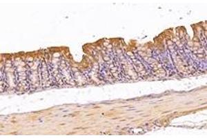 Immunohistochemistry analysis of paraffin-embedded mouse colon using,KIF5B (ABIN7074440) at dilution of 1: 1000 (KIF5B Antikörper)