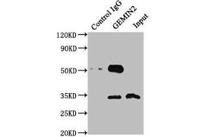 Immunoprecipitating GEMIN2 in 293T whole cell lysate Lane 1: Rabbit control IgG instead of ABIN7153753 in 293T whole cell lysate. (SIP1 Antikörper  (AA 1-280))
