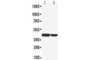 Anti-Cytokeratin 19 antibody, Western blotting Lane 1:  Cell Lysate Lane 2: COLO320 Cell Lysate