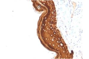 Immunohistochemistry (IHC) image for anti-Keratin 15 (KRT15) antibody (ABIN6939913)