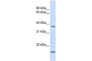 WB Suggested Anti-ZDHHC19 Antibody Titration:  0. (ZDHHC19 Antikörper  (N-Term))
