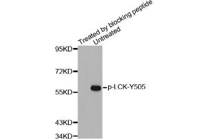 Western blot analysis of extracts from JK cells using Phospho-LCK-Y505 antibody and the same antibody preincubated with blocking peptide. (LCK Antikörper  (pTyr505))