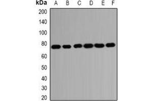Western blot analysis of HSPA2 expression in SKOV3 (A), Hela (B), A431 (C), mouse brain (D), mouse testis (E), rat kidney (F) whole cell lysates.