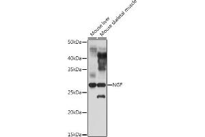 Western blot analysis of extracts of various cell lines, using NGF antibody (ABIN3020811, ABIN3020812, ABIN3020813 and ABIN6213735) at 1:1000 dilution. (Nerve Growth Factor Antikörper  (AA 19-241))